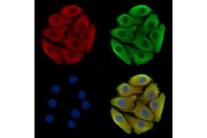 ABIN7096638 and ABIN7100703 staining Hela cells by IF/ICC.