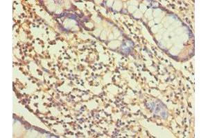 Immunohistochemistry of paraffin-embedded human small intestine tissue using ABIN7167765 at dilution of 1:100 (ALDH1A1 抗体  (AA 202-501))