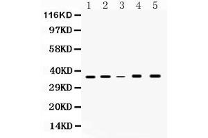 Western blot analysis of GAPDH expression in rat brain extract ( Lane 1), rat kidney extract ( Lane 2), mouse kidney extract ( Lane 3), HELA whole cell lysates ( Lane 4) and MCF-7 whole cell lysates( Lane 5).