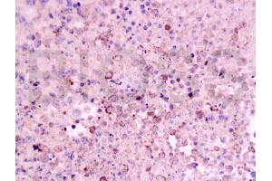 Formalin-fixed and paraffin embedded mouse lymphoma tissue labeled Anti-CD8 Polyclonal Antibody, Unconjugated (ABIN671391) at 1:200, followed by conjugation to the secondary antibody and DAB staining (CD8 抗体  (AA 51-150))