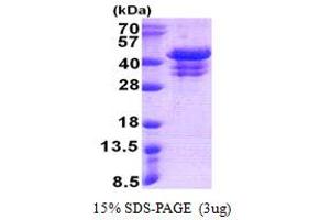 Ubiquitin Fusion Degradation Protein 1 Homolog (UFD1L) (AA 1-307) protein (His tag)