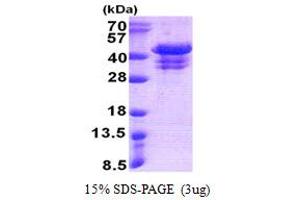 SDS-PAGE (SDS) image for Ubiquitin Fusion Degradation Protein 1 Homolog (UFD1L) (AA 1-307) protein (His tag) (ABIN5853130) (UFD1L Protein (AA 1-307) (His tag))