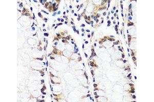 Immunohistochemistry (Paraffin-embedded Sections) (IHC (p)) image for anti-Cullin-Associated and Neddylation-Dissociated 1 (CAND1) antibody (ABIN7257782)