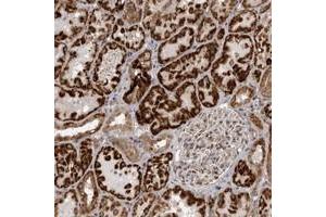 Immunohistochemical staining of human kidney with C1orf109 polyclonal antibody  shows strong cytoplasmic positivity in cells of renal tubles. (C1ORF109 抗体)