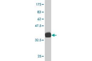 Western Blot detection against Immunogen (36. (LIM Domain Kinase 1 抗体  (AA 548-647))