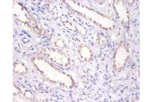 Immunohistochemistry of paraffin-embedded human kidney tissue using ABIN7145696 at dilution of 1:100 (BMP6 抗体  (AA 382-513))