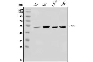 Western blot analysis of LXR beta/NER/NR1H2 using anti-LXR beta/NER/NR1H2 antibody (ABIN7601265).