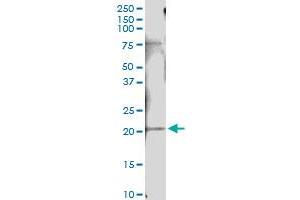 Immunoprecipitation of IFNA10 transfected lysate using anti-IFNA10 MaxPab rabbit polyclonal antibody and Protein A Magnetic Bead , and immunoblotted with IFNA10 purified MaxPab mouse polyclonal antibody (B01P) . (IFNA10 抗体  (AA 1-189))