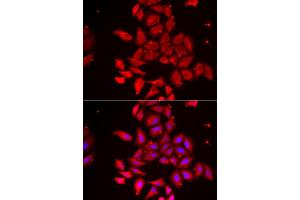 Immunofluorescence analysis of U2OS cell using TMOD4 antibody. (Tropomodulin 4 抗体)