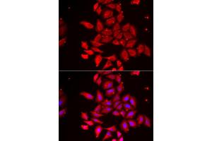 Immunofluorescence analysis of U2OS cell using TMOD4 antibody.