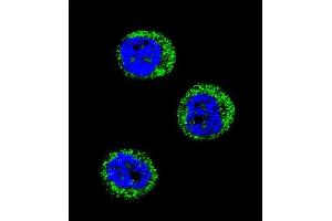 Confocal immunofluorescent analysis of HP Antibody (Center) (ABIN654637 and ABIN2844334) with MDA-M cell followed by Alexa Fluor 488-conjugated goat anti-rabbit lgG (green). (Haptoglobin 抗体  (Center))