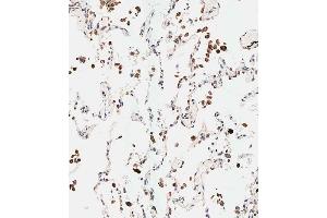 Immunohistochemical analysis of paraffin-embedded human lung tissue using (ABIN653920 and ABIN2843154) performed on the Leica® BOND RXm. (NUP210 抗体  (N-Term))