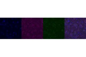 Immunohistochemistry (IHC) image for anti-Interleukin 12 alpha (IL12A) antibody (ABIN7456134) (IL12A 抗体)