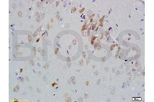 Formalin-fixed and paraffin embedded rat brain labeled with Anti-GDNF-Receptor-alpha-2 Polyclonal Antibody, Unconjugated (ABIN724235) 1:200 followed by conjugation to the secondary antibody and DAB staining