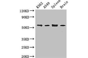 Western Blot Positive WB detected in: K562 whole cell lysate, A549 whole cell lysate, Mouse spleen tissue, Mouse brain tissue All lanes: CORO1C antibody at 3.
