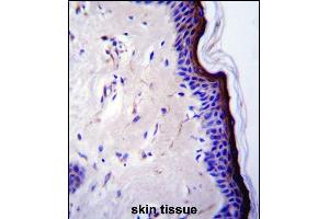 p53 Antibody (T55) (ABIN390200 and ABIN2840687) immunohistochemistry analysis in formalin fixed and paraffin embedded human skin tissue followed by peroxidase conjugation of the secondary antibody and DAB staining. (p53 抗体  (AA 33-62))