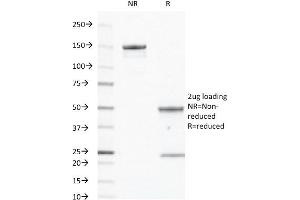 SDS-PAGE Analysis of Purified CD40 Mouse Monoclonal Antibody ABIN6383879. (CD40 抗体  (Extracellular Domain))