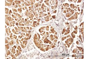 Immunoperoxidase of purified MaxPab antibody to CPA2 on formalin-fixed paraffin-embedded human pancreas. (Carboxypeptidase A2 抗体  (AA 1-417))