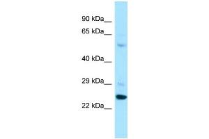 Host: Rabbit Target Name: PARS2 Sample Type: A549 Whole Cell lysates Antibody Dilution: 1. (PARS2 抗体  (C-Term))