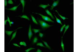 Immunofluorescence staining of Hela cells with ABIN7162338 at 1:133, counter-stained with DAPI. (OTUD7B 抗体  (AA 235-347))