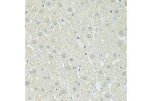 Immunohistochemistry of paraffin-embedded rat liver using SLC40A1 antibody (ABIN6292414) at dilution of 1:100 (40x lens). (SLC40A1 抗体)