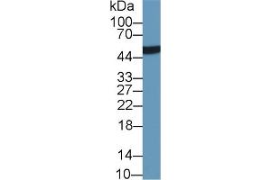 Detection of LRG1 in Human Urine using Monoclonal Antibody to Leucine Rich Alpha-2-Glycoprotein 1 (LRG1) (LRG1 抗体  (AA 37-340))