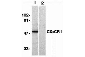 Western Blotting (WB) image for anti-Chemokine (C-X3-C Motif) Receptor 1 (CX3CR1) (N-Term) antibody (ABIN1031335) (CX3CR1 抗体  (N-Term))