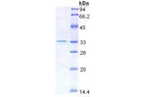 SDS-PAGE analysis of Mouse HMG1 Protein. (HMGB1 蛋白)