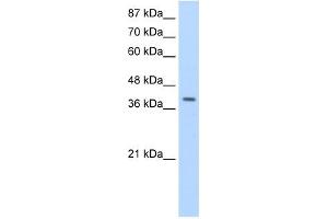 LARP7 antibody used at 1. (LARP7 抗体  (C-Term))