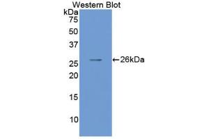 Western blot analysis of the recombinant protein. (SMAD1 抗体  (AA 270-465))