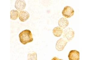 Immunocytochemistry staining of HeLa cells using AP30343PU-N FLIP antibody at 2 μg/ml. (FLIP 抗体  (C-Term))