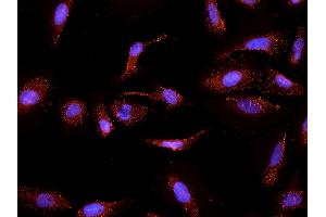 Immunocytochemistry (ICC) image for anti-Cytochrome P450, Family 26, Subfamily A, Polypeptide 1 (CYP26A1) (Internal Region) antibody (ABIN5539703)