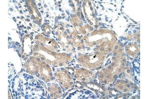 ADH1B antibody was used for immunohistochemistry at a concentration of 4-8 ug/ml to stain Epithelial cells of renal tubule (arrows) in Human Kidney. (ADH1B 抗体)