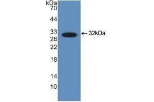 Detection of Recombinant DDIT3, Human using Polyclonal Antibody to DNA Damage Inducible Transcript 3 (DDIT3) (DDIT3 抗体  (AA 1-169))