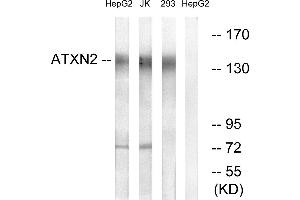 Western blot analysis of extracts from HepG2 cells, Jurkat cells and 293 cells, using ATXN2 antibody. (Ataxin 2 抗体)
