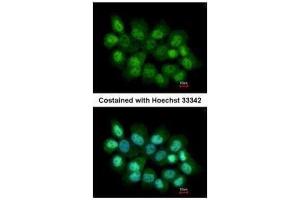 ICC/IF Image Immunofluorescence analysis of paraformaldehyde-fixed A431, using PRMT2, antibody at 1:200 dilution. (PRMT2 抗体)