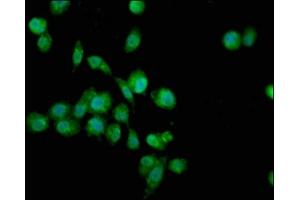 Immunofluorescence staining of SH-SY5Y cells with ABIN7166416 at 1:100, counter-stained with DAPI. (TGM4 抗体  (AA 1-684))