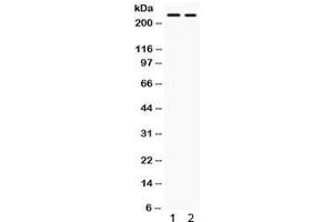 Western blot testing of human 1) SW620 and 2) HepG2 lysate with ARID1A antibody. (ARID1A 抗体)