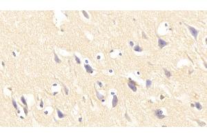 Immunohistochemistry (IHC) image for anti-Interleukin 1 Receptor-Like 1 (IL1RL1) (AA 162-349) antibody (ABIN7437368)