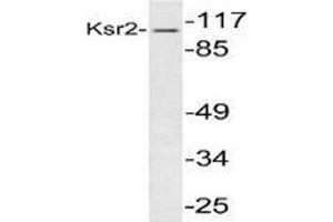 Western blot analysis of KSR2 in extracts from 293 cells using Kinase suppressor of Ras 2 antibody . (KSR2 抗体)
