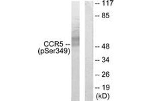 Western blot analysis of extracts from RAW264. (CCR5 抗体  (pSer349))