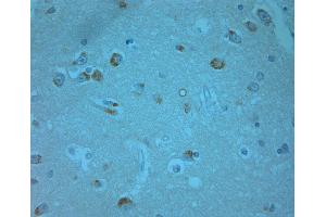 human olfactory-1 (ERK1/2 抗体  (pThr202, pTyr204))