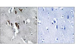 Immunohistochemistry analysis of paraffin-embedded human brain tissue using ELOVL5 antibody. (ELOVL5 抗体  (C-Term))