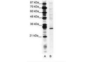 Image no. 1 for anti-Ring Finger Protein 141 (RNF141) (AA 96-145) antibody (ABIN202098) (RNF141 抗体  (AA 96-145))
