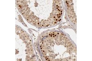 Immunohistochemical staining of human testis with CTCFL polyclonal antibody  shows strong nuclear positivity in primary spermatocytes. (CTCFL 抗体)