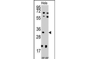 Western blot analysis of UCK2 polyclonal antibody  pre-incubated with and without blocking peptide (BP7192a) in HeLa cell line lysate. (UCK2 抗体  (N-Term))