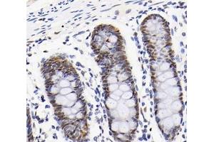 Immunohistochemistry analysis of paraffin-embedded human colon using,RBM14 (ABIN7075474) at dilution of 1: 2000