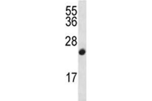 CDKN2B antibody western blot analysis in CEM lysate (CDKN2B 抗体  (AA 103-131))