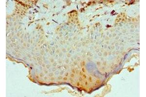 Immunohistochemistry of paraffin-embedded human skin tissue using ABIN7147709 at dilution of 1:100 (CBX8 抗体  (AA 80-280))