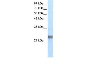 Transfected 293T; WB Suggested Anti-ZNF313 Antibody Titration: 1. (RNF114 抗体  (N-Term))